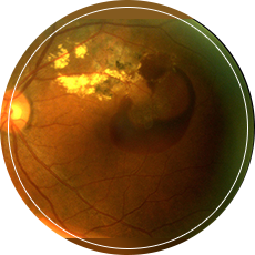 The Radiant Eye Centre Pte Ltd.