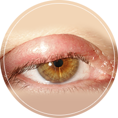 The Radiant Eye Centre Pte Ltd.